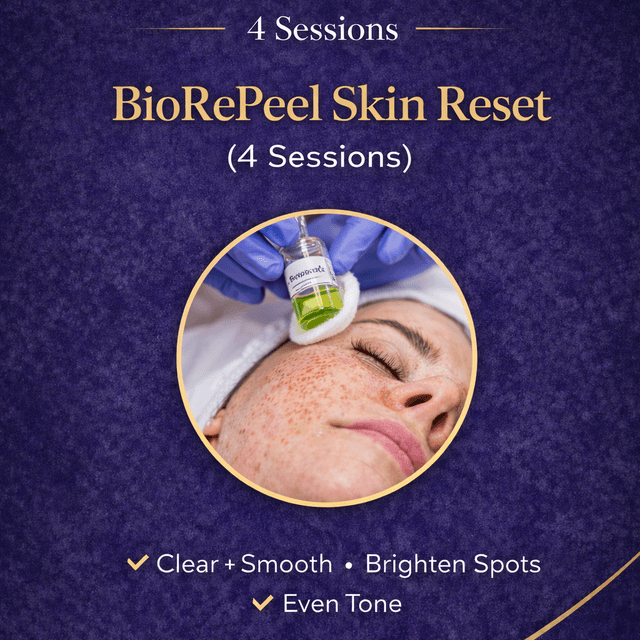 BioRePeel Skin Reset (4 Sessions)