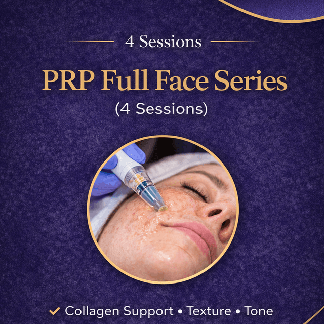 PRP Full Face Series (4 Sessions)